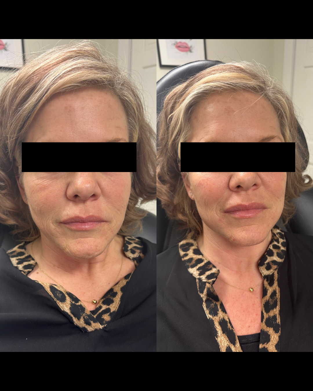 Skin Transformation Progress